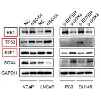 E2F1 Rabbit mAb