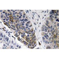 IgA Polyclonal Antibody