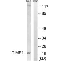 TIMP1 Antibody 