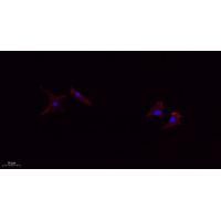 TIMP1 Antibody 