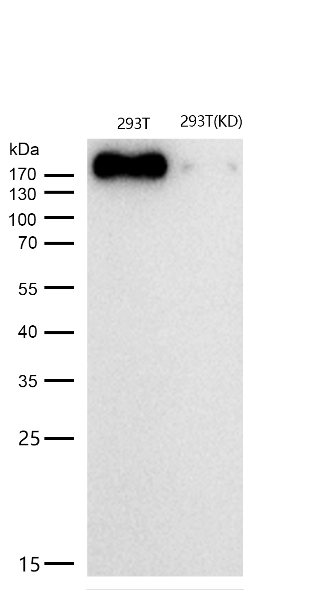 ErbB2 (HER2) Rabbit mAb