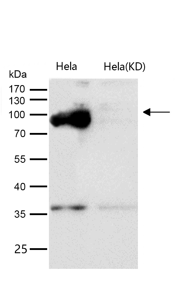 RanBP9 Rabbit mAb