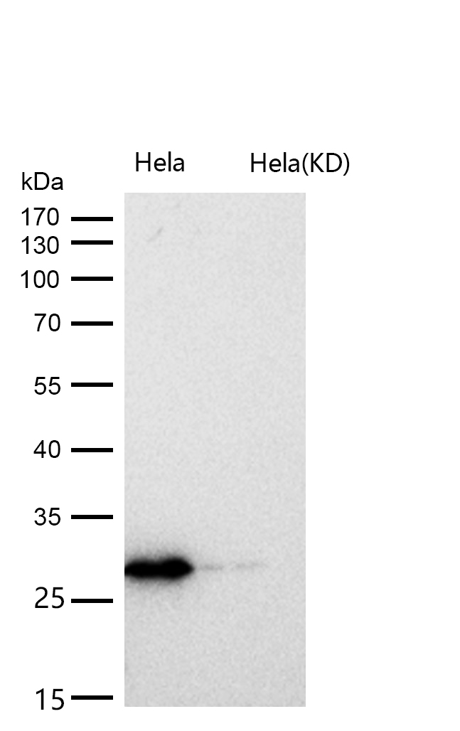 CHMP2B Rabbit mAb