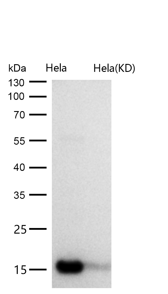 AP2S1 Rabbit mAb