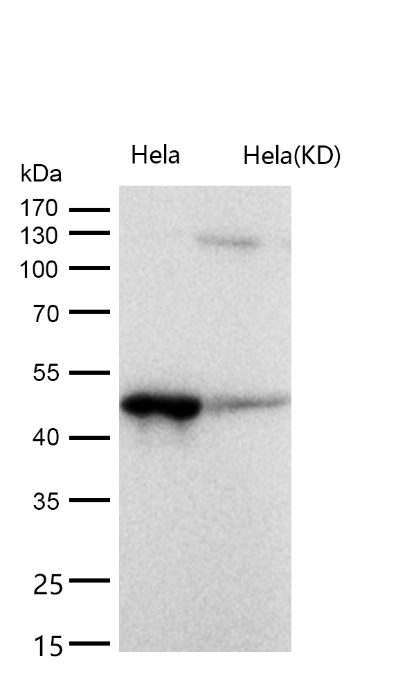 ACAA2 Rabbit mAb