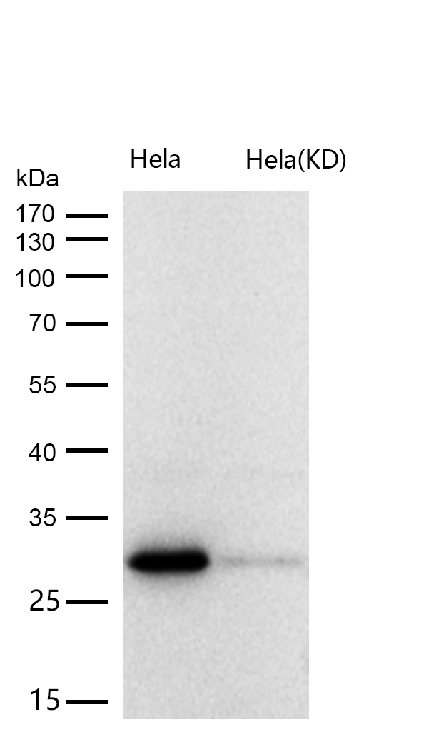 BRMS1 Rabbit mAb