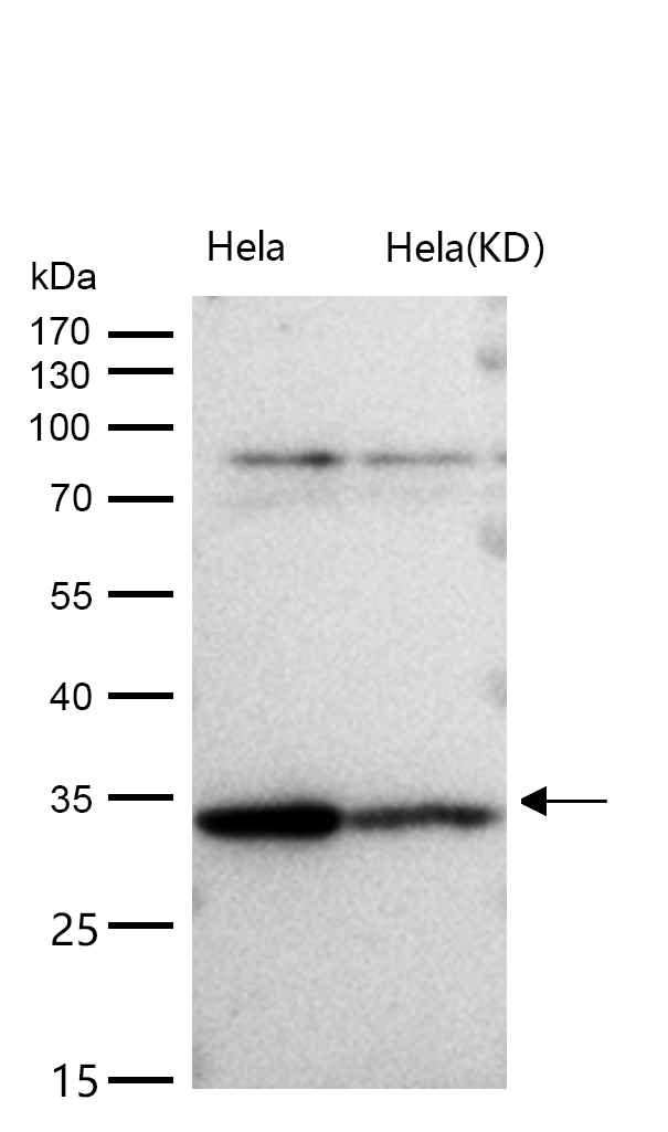 ARPC2 Rabbit mAb