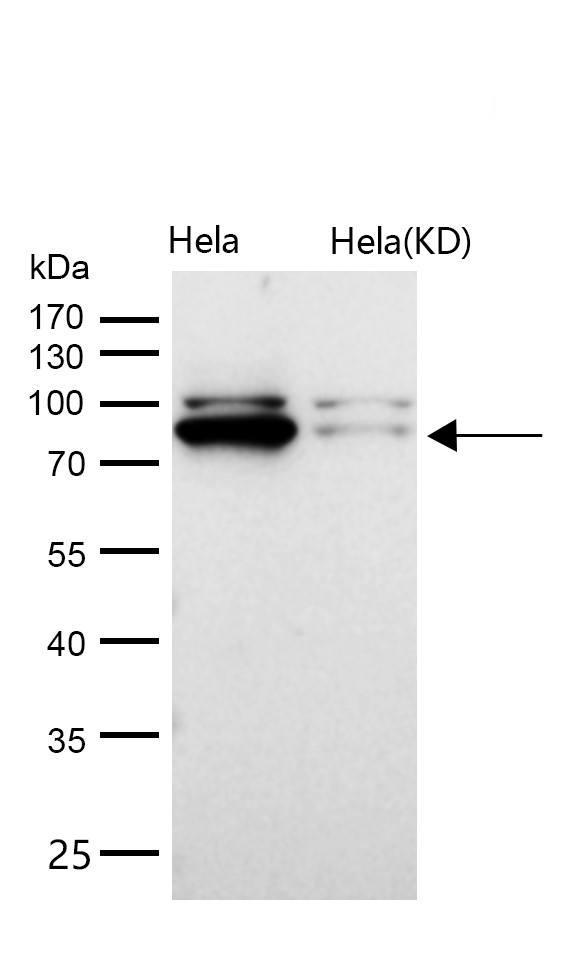 CLPTM1 Rabbit mAb