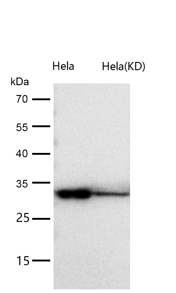 CLIC4 Rabbit mAb