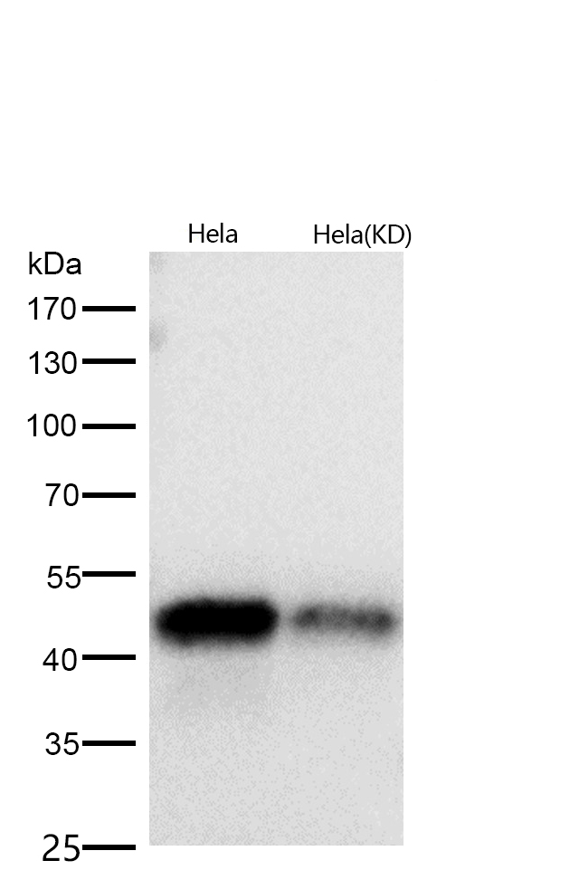 NF-κB (p105/p50) Rabbit mAb