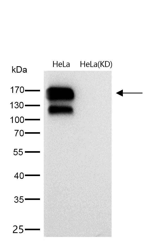 Integrin beta 1 Rabbit mAb