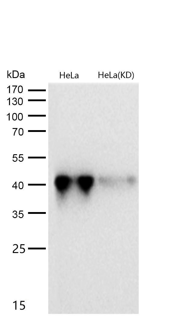 Glutamine Synthetase Rabbit mAb  