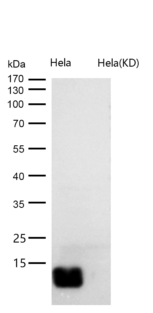 beta 2 Microglobulin Rabbit mAb