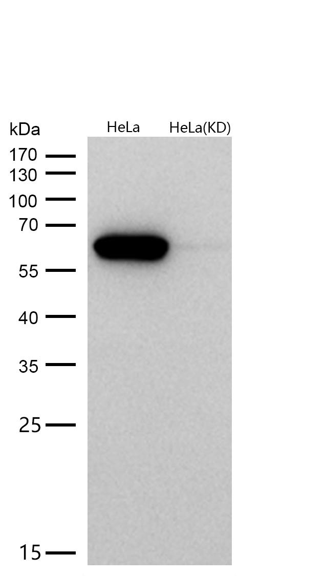 Calreticulin Rabbit mAb