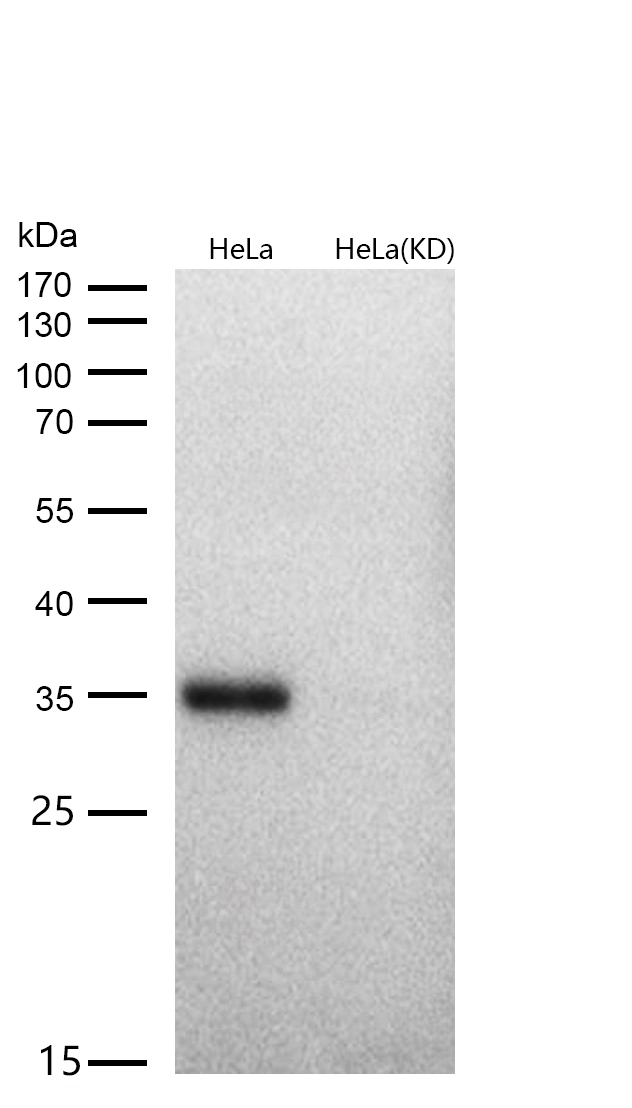Cyclin D1 Rabbit mAb