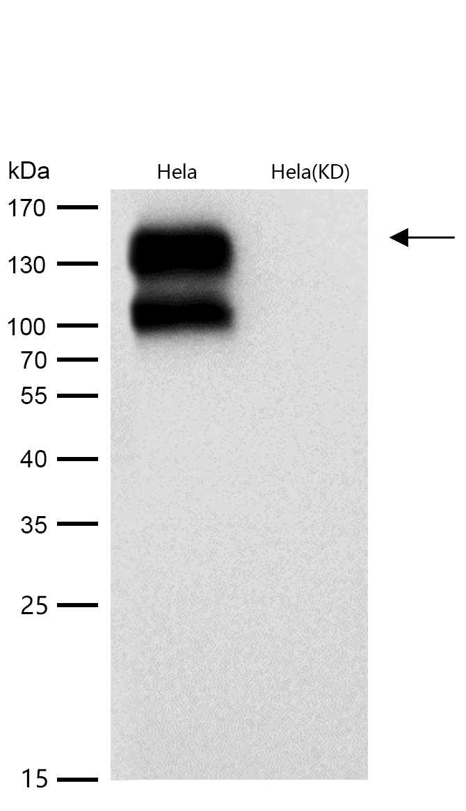 Integrin beta 1 Rabbit mAb