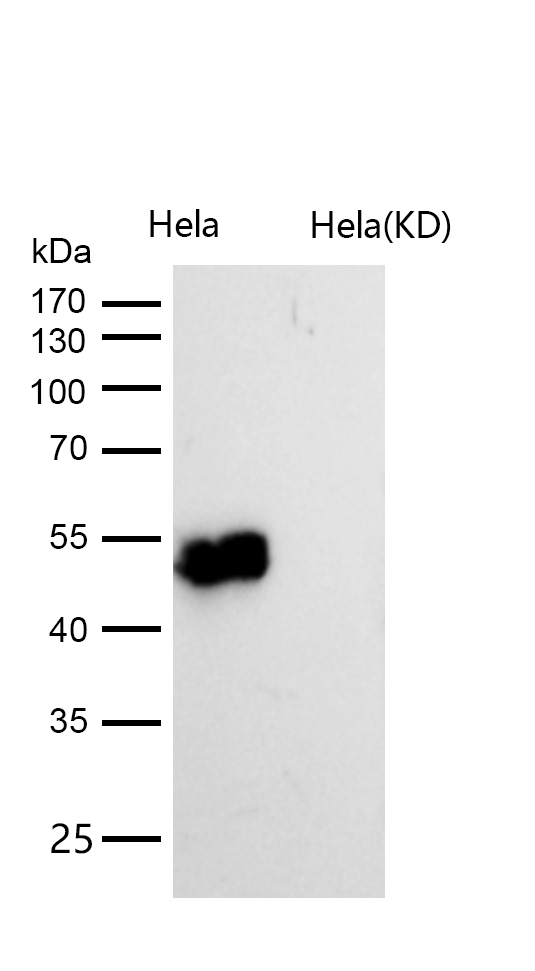 Cyclin E2 Rabbit mAb