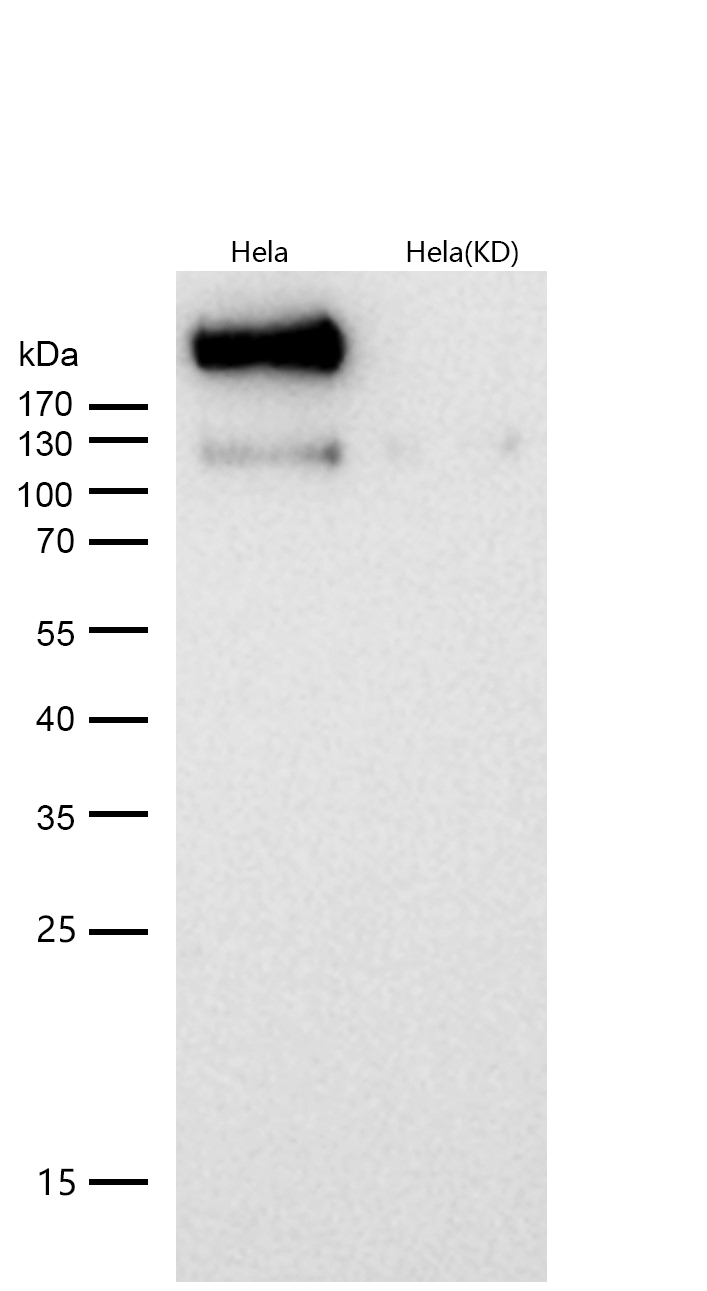 DNA-PKcs Rabbit mAb