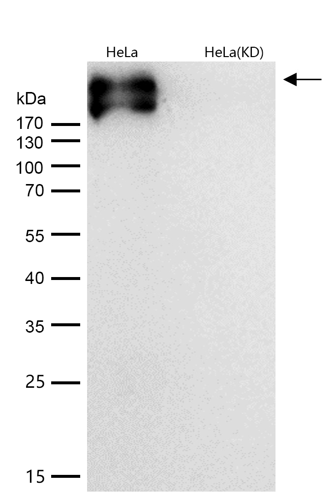 Fibronectin Rabbit mAb