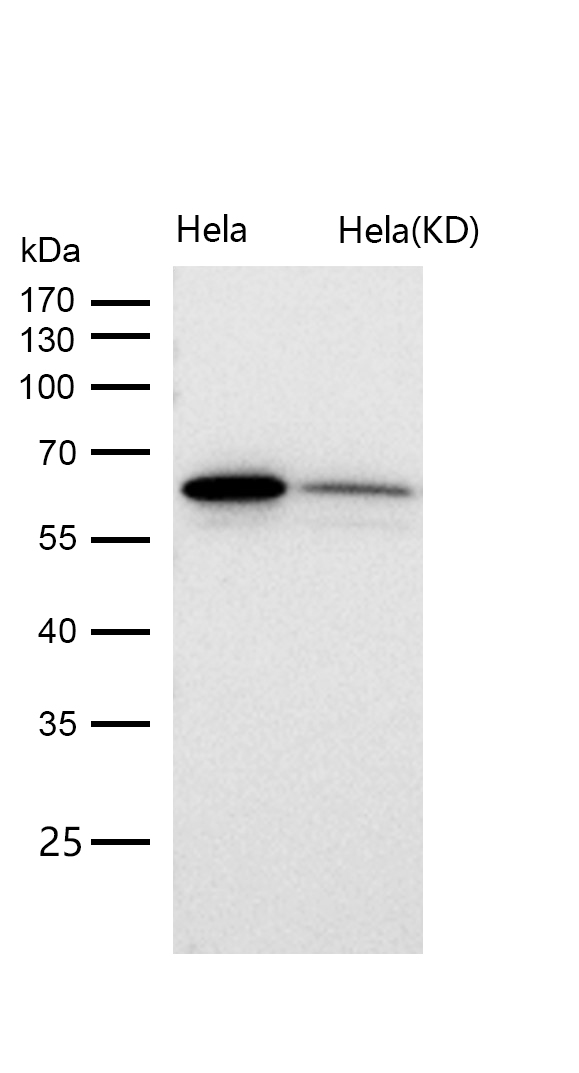 hnRNP K Rabbit mAb