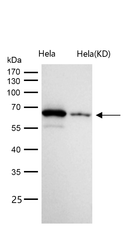 Chk2 Rabbit mAb