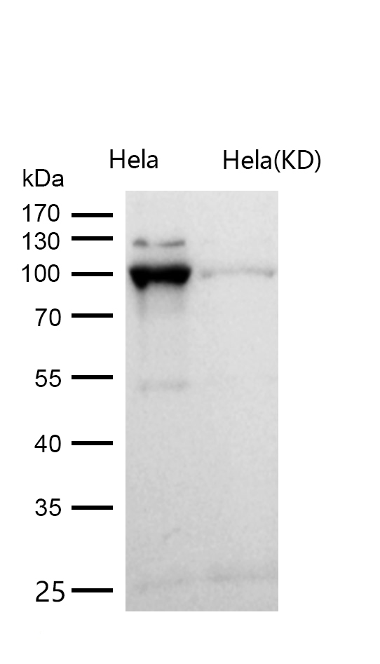 Catenin alpha 1 Rabbit mAb