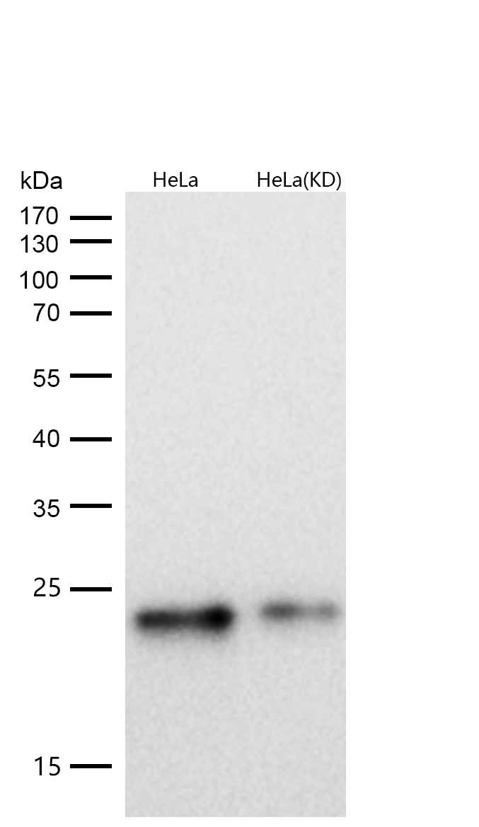 Ferritin Rabbit mAb