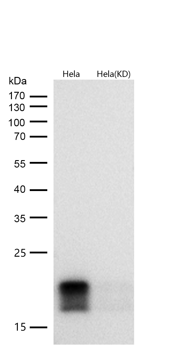 eIF4EBP1 Rabbit mAb