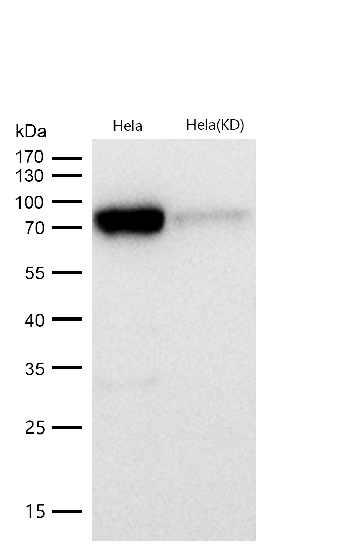 PKC delta Rabbit mAb