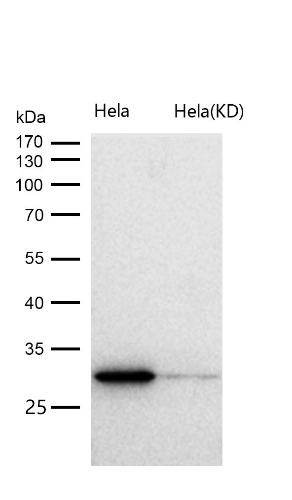 Carbonic anhydrase 2 Rabbit mAb