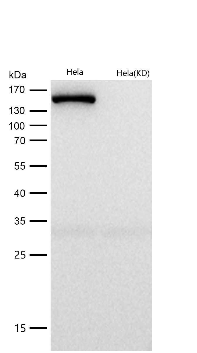 ROCK2 Rabbit mAb