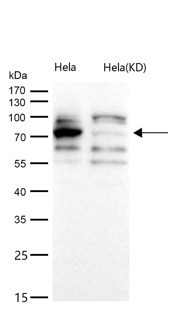 Calpain 2 Rabbit mAb