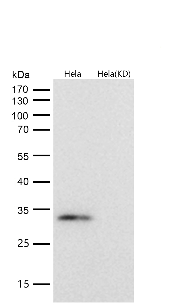 GC1q R Rabbit mAb