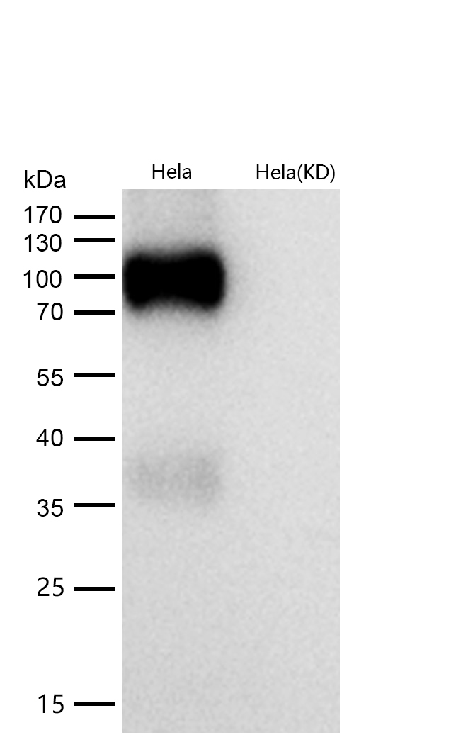 ApoER2 Rabbit mAb