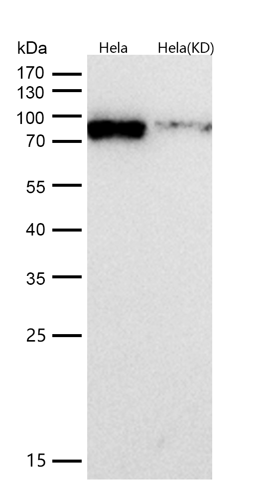 KAT7 / HBO1 / MYST2 Rabbit mAb