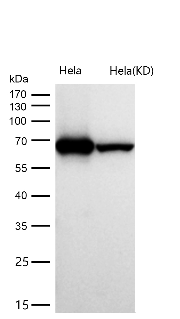 DDX5 Rabbit mAb