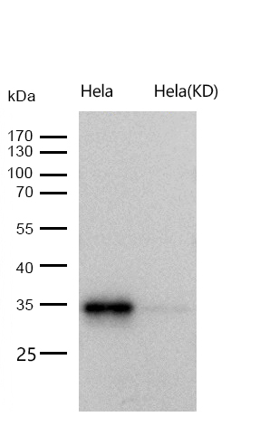 PRKRA Rabbit mAb