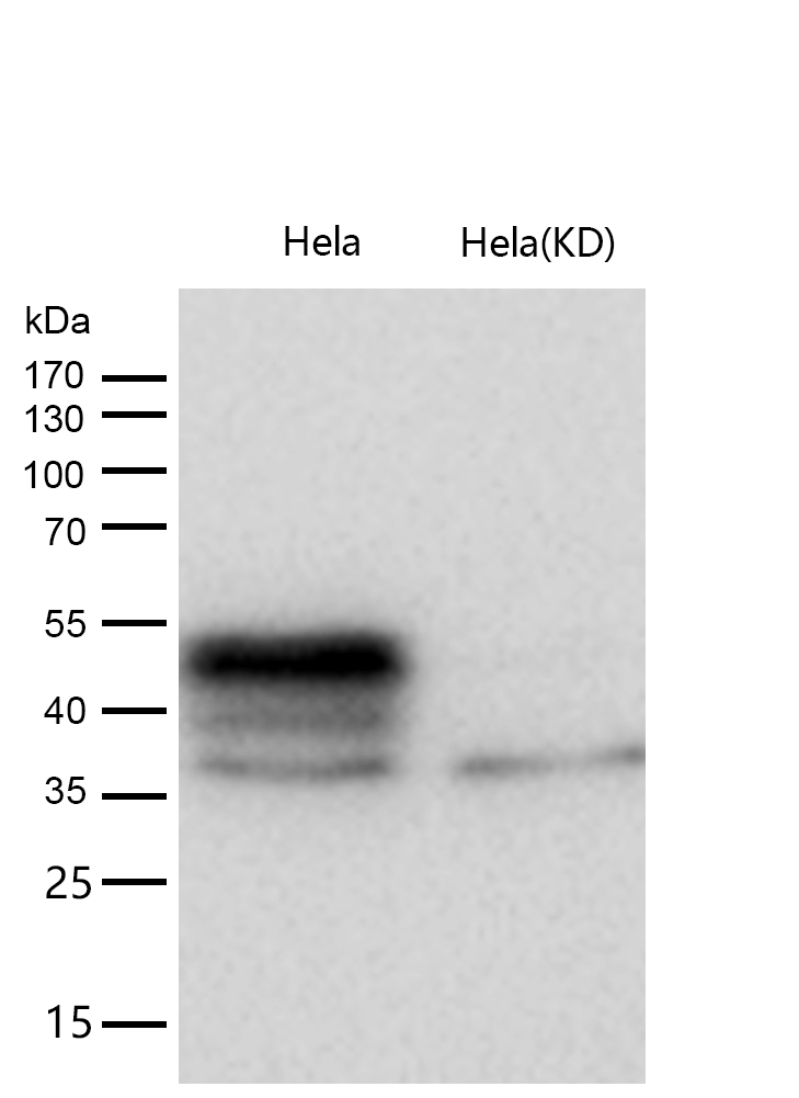 TEAD1 Rabbit mAb