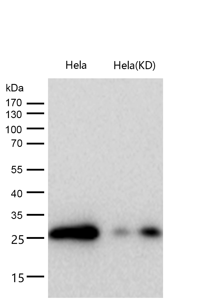 CLPP Rabbit mAb