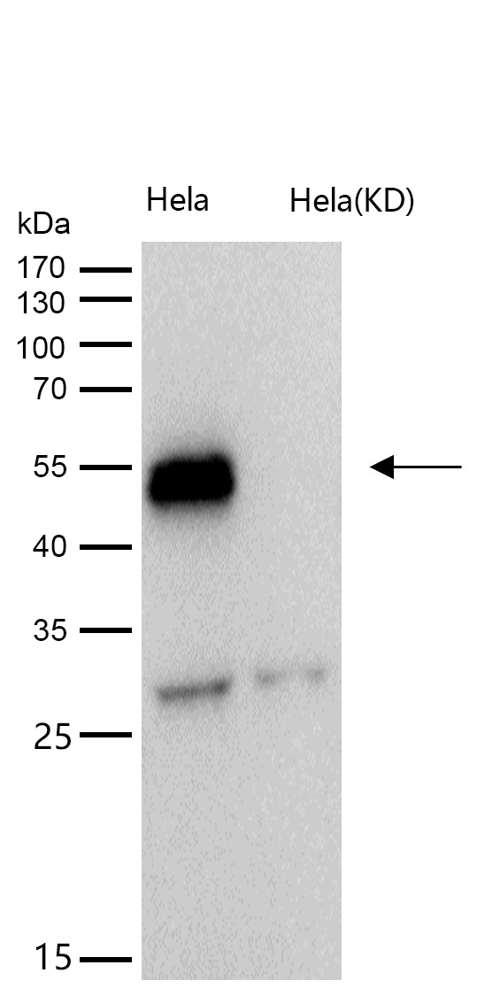 TEAD1 Rabbit mAb