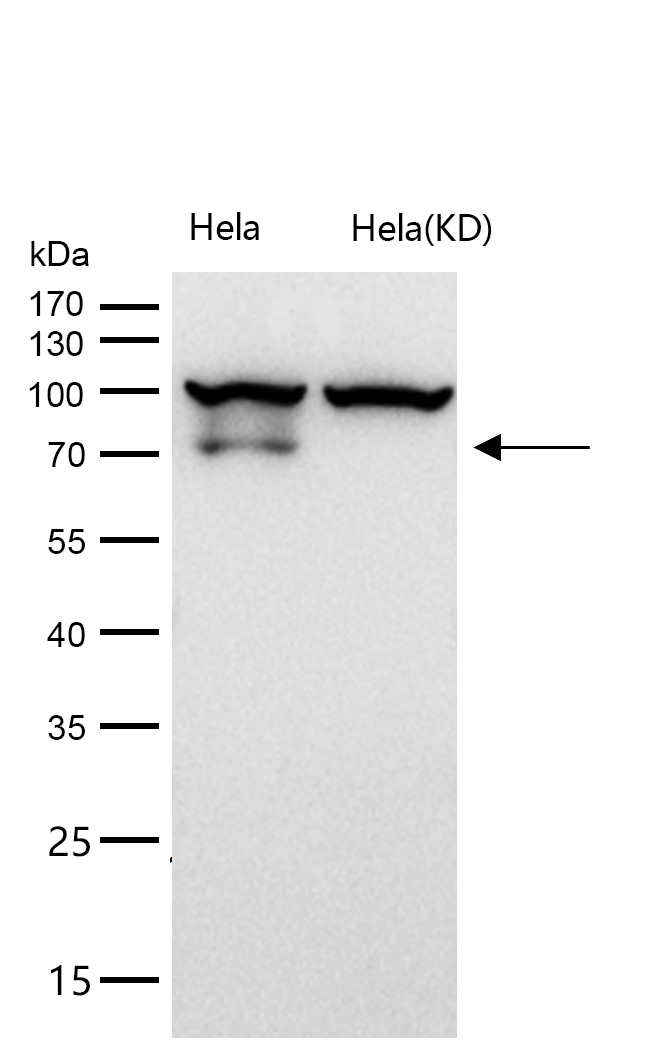 GLB1 Rabbit mAb