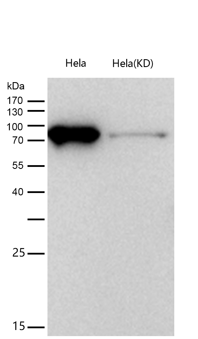 PLAP Rabbit mAb