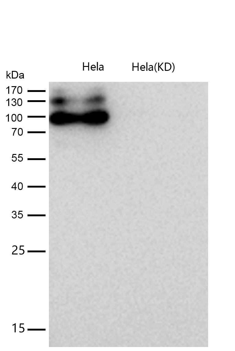 APLP2 Rabbit mAb