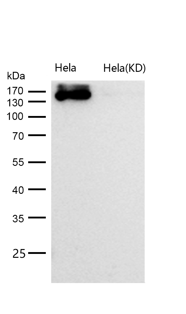 SUPT5H Rabbit mAb