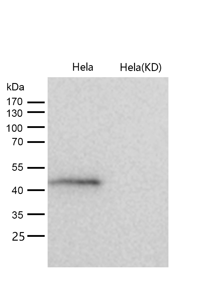 ADK Rabbit mAb