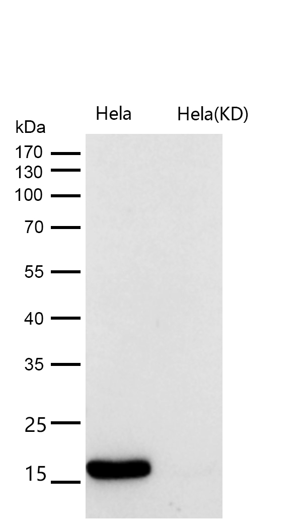 Histone H3 (acetyl K18) Rabbit mAb