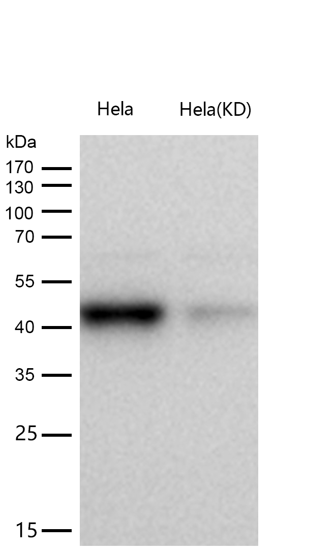 ALKBH1 Rabbit mAb