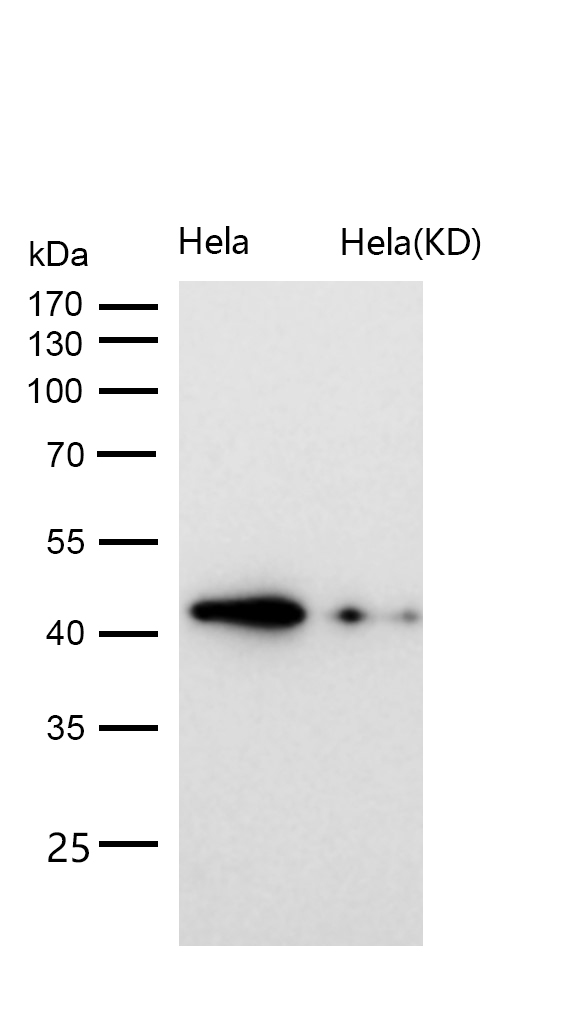 TDP43 Rabbit mAb