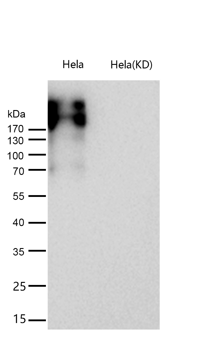 Fibronectin Rabbit mAb