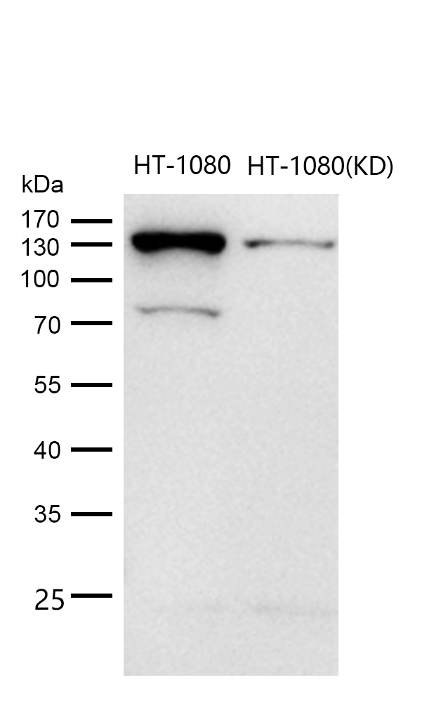 RASA1 Rabbit mAb